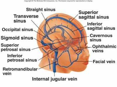 imagini tromboflebita cerebrala